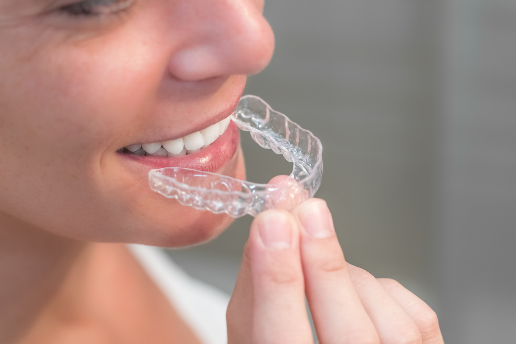 Woman wearing invisible braces aligner. mobile orthodontic appliance for dental correction.